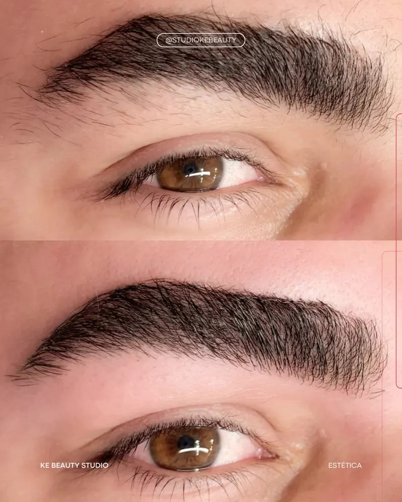 Antes e depois de design de sobrancelha: em cima os fios desalinhados, embaixo a sobrancelha limpa e alinhada